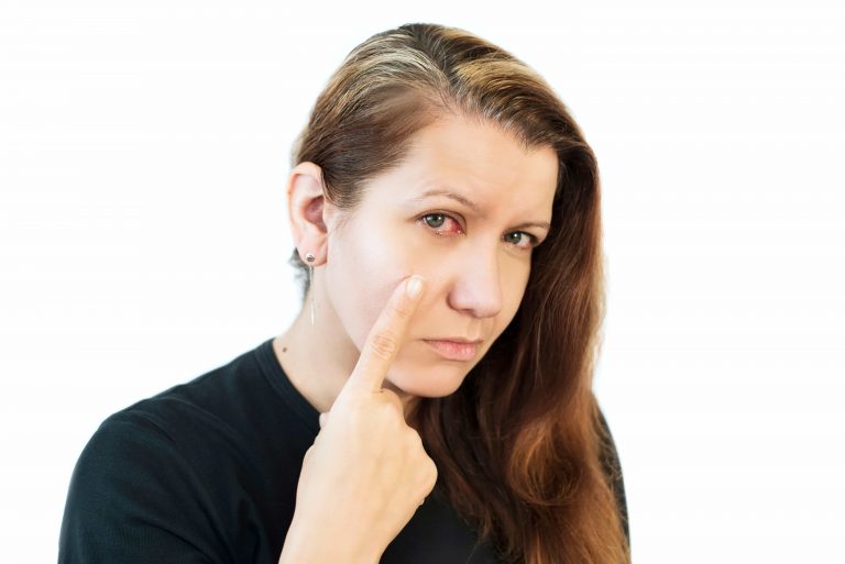 Göz Seğirmesi Nedir? Nasıl Tedavi Edilir?