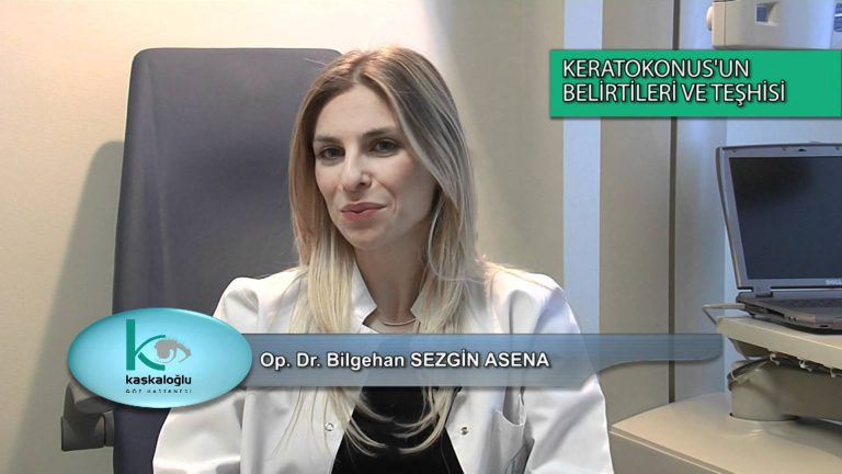 Keratokonus belirtileri