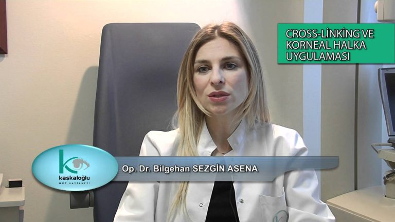 Keratokonus, Kornea halka uygulaması, CXL Cross linking