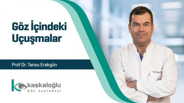 Göz İçindeki Uçuşmalar