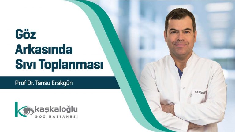 Göz Arkasında Sıvı Toplanması