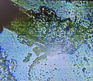 demodex