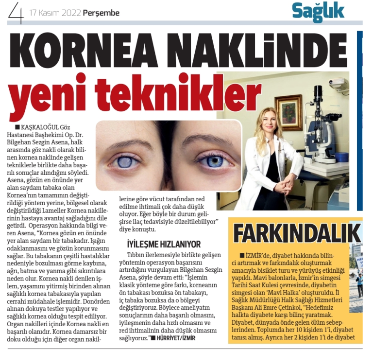 Kornea Naklinde Yeni Teknikler Avantaj Sağlıyor