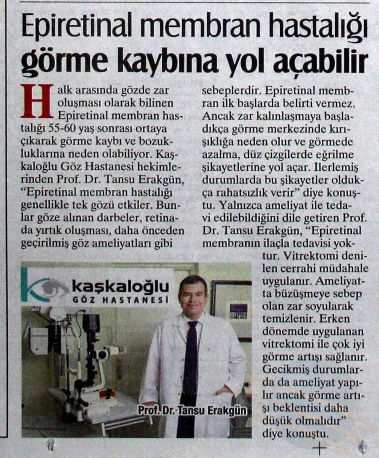 Epiretinal membran hastalığı görme kaybına yol açabilir!