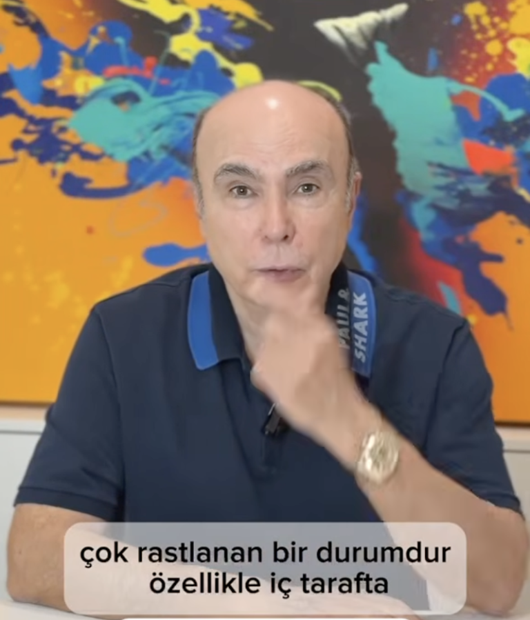 Gözün Beyazındaki Sarı Leke (Pinguekula)